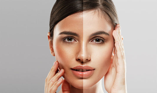 Skin Unifying vs Skin Lightening: What’s the Difference?